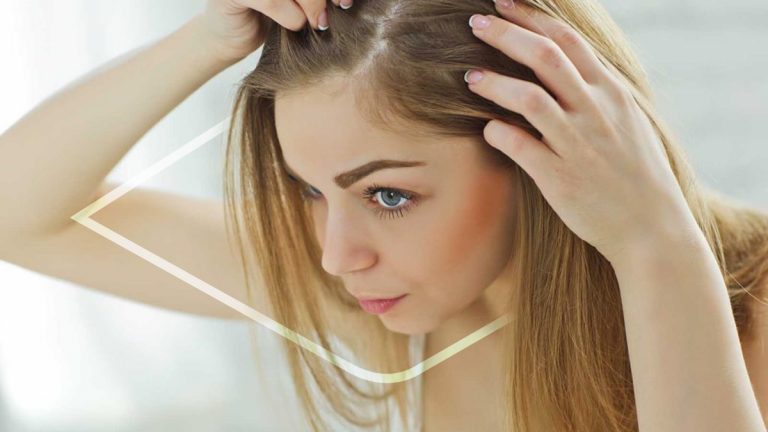 Tratamientos para alopecia en mujeres