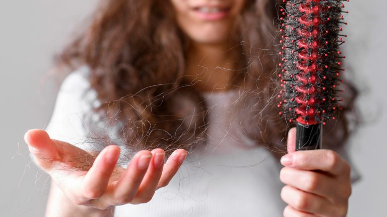 ¿Qué es la alopecia en mujeres?