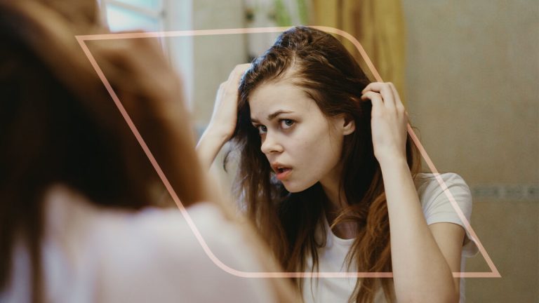 alopecia por tracción