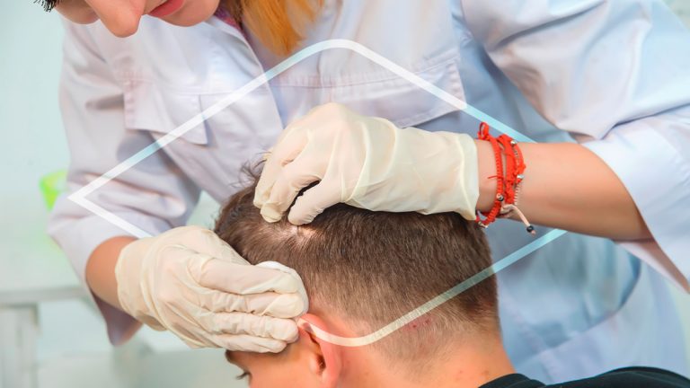 Paciente recibiendo una valoración para recibir un trasplante de cabello