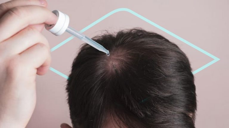 ¿Cuáles son las instrucciones del minoxidil?