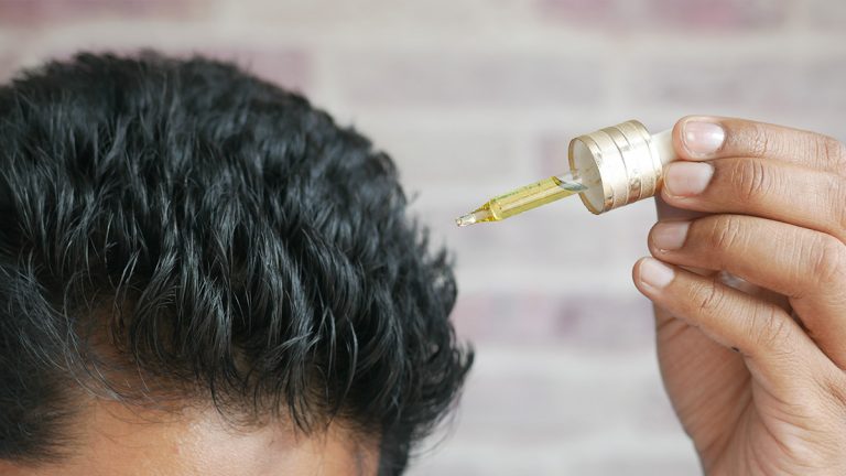 ¿Cuál es la diferencia entre el minoxidil y el trioxidil?