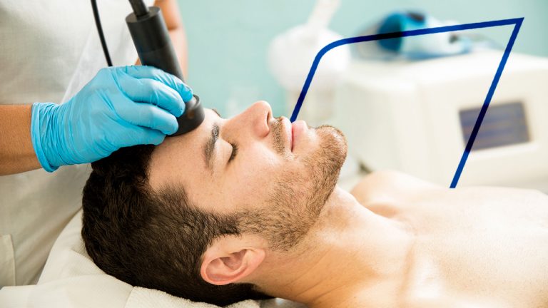 Rejuvenecimiento facial para hombres