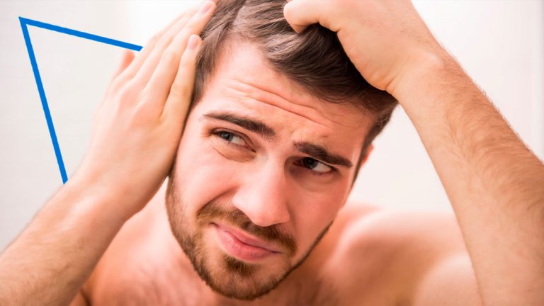 Si tienes alopecia, ¿vuelve a crecer el pelo?