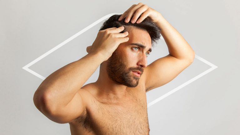 ¿Cuáles son las contraindicaciones del minoxidil?